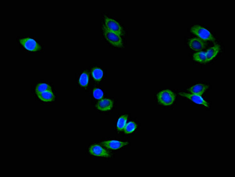 COMMD1 Antibody - Immunofluorescent analysis of HepG2 cells using COMMD1 Antibody at a dilution of 1:100 and Alexa Fluor 488-congugated AffiniPure Goat Anti-Rabbit IgG(H+L)