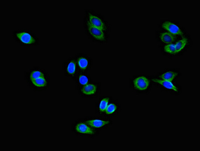 COMMD1 Antibody - Immunofluorescent analysis of HepG2 cells using COMMD1 Antibody at dilution of 1:100 and Alexa Fluor 488-congugated AffiniPure Goat Anti-Rabbit IgG(H+L)