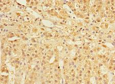 COMMD1 Antibody - Immunohistochemistry of paraffin-embedded human adrenal gland tissue at dilution 1:100