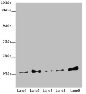 COMMD1 Antibody - Western blot All Lanes: COMMD1antibody at 5.36ug/ml Lane 1 : A549 whole cell lysate Lane 2 : Jurkat whole cell lysate Lane 3 : MCF7 whole cell lysate Lane 4 : Hela whole cell lysate Lane 5 : HepG-2 whole cell lysate Secondary Goat polyclonal to Rabbit IgG at 1/10000 dilution Predicted band size: 22,18 kDa Observed band size: 21 kDa