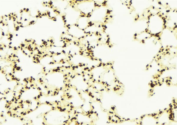 COMMD1 Antibody - 1:100 staining mouse lung tissue by IHC-P. The sample was formaldehyde fixed and a heat mediated antigen retrieval step in citrate buffer was performed. The sample was then blocked and incubated with the antibody for 1.5 hours at 22°C. An HRP conjugated goat anti-rabbit antibody was used as the secondary.