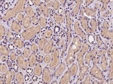COMMD10 Antibody - Immunochemical staining of human COMMD10 in human kidney with rabbit polyclonal antibody at 1:100 dilution, formalin-fixed paraffin embedded sections.