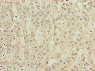 COMMD2 Antibody - Immunohistochemistry of paraffin-embedded human adrenal gland tissue using COMMD2 Antibody at dilution of 1:100