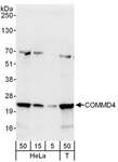 COMMD4 Antibody - Detection of Human COMMD4 by Western Blot. Samples: Whole cell lysate from HeLa (5, 15 and 50 ug for WB) and 293T (T; 50 ug) cells. Antibodies: Affinity purified rabbit anti-COMMD4 antibody used for WB at 0.4 ug/ml. Detection: Chemiluminescence with an exposure time of 10 seconds.