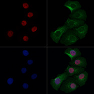 COMMD5 Antibody - Staining HeLa cells by IF/ICC. The samples were fixed with PFA and permeabilized in 0.1% Triton X-100, then blocked in 10% serum for 45 min at 25°C. Samples were then incubated with primary Ab(1:200) and mouse anti-beta tubulin Ab(1:200) for 1 hour at 37°C. An AlexaFluor594 conjugated goat anti-rabbit IgG(H+L) Ab(1:200 Red) and an AlexaFluor488 conjugated goat anti-mouse IgG(H+L) Ab(1:600 Green) were used as the secondary antibod