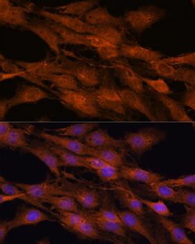 COMMD5 Antibody - Immunofluorescence analysis of C6 cells using COMMD5 Polyclonal Antibody at dilution of 1:100.Blue: DAPI for nuclear staining.