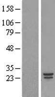 COMMD5 Protein - Western validation with an anti-DDK antibody * L: Control HEK293 lysate R: Over-expression lysate