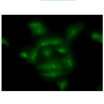 COMMD7 Antibody - ICC/IF analysis of COMMD7 in A549 cells line, stained with monoclonal anti-human COMMD7 antibody (1:100) with goat anti-mouse IgG-Alexa fluor 488 conjugate (Green).