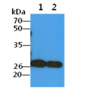COMMD7 Antibody - The Cell lysates (40ug) were resolved by SDS-PAGE, transferred to PVDF membrane and probed with anti-human COMMD7 antibody (1:1000). Proteins were visualized using a goat anti-mouse secondary antibody conjugated to HRP and an ECL detection system. Lane 1.: A549 cell lysate Lane 2.: HepG2 cell lysate