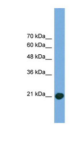 COMMD8 Antibody - COMMD8 antibody Western blot of Transfected 293T cell lysate. This image was taken for the unconjugated form of this product. Other forms have not been tested.