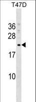 COMMD9 Antibody - COMMD9 Antibody western blot of T47D cell line lysates (35 ug/lane). The COMMD9 antibody detected the COMMD9 protein (arrow).