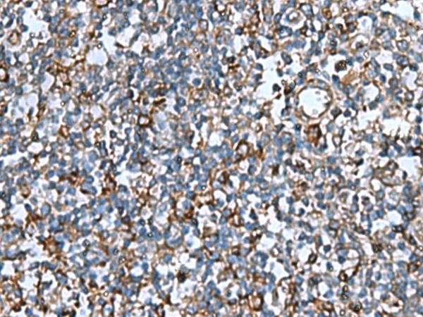COMMD9 Antibody - Immunohistochemistry of paraffin-embedded Human tonsil tissue  using COMMD9 Polyclonal Antibody at dilution of 1:60(×200)