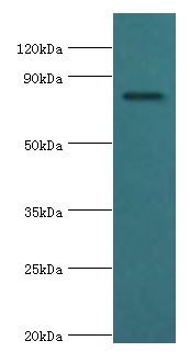 COMP / THBS5 Antibody - Western blot. All lanes: Cartilage oligomeric matrix protein antibody at 4 ug/ml+mouse skeletal muscle tissue. Secondary antibody: Goat polyclonal to rabbit at 1:10000 dilution. Predicted band size: 83 kDa. Observed band size: 83 kDa.