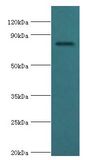 COMP / THBS5 Antibody - Western blot. All lanes: Cartilage oligomeric matrix protein antibody at 4 ug/ml+mouse skeletal muscle tissue. Secondary antibody: Goat polyclonal to rabbit at 1:10000 dilution. Predicted band size: 83 kDa. Observed band size: 83 kDa.