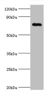 COMP / THBS5 Antibody - Western blot All lanes: Cartilage oligomeric matrix protein antibody at 4µg/ml + Mouse skeletal muscle tissue Secondary Goat polyclonal to rabbit IgG at 1/10000 dilution Predicted band size: 83, 78 kDa Observed band size: 83 kDa