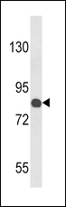 COMP / THBS5 Antibody - Western blot of COMP Antibody in Jurkat cell line lysates (35 ug/lane). COMP (arrow) was detected using the purified antibody.