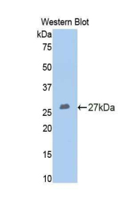 COMP / THBS5 Antibody - Western blot of recombinant COMP.