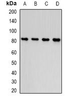 COMP / THBS5 Antibody - Western blot analysis of Thrombospondin-5 expression in HepG2 (A); MCF7 (B); mouse heart (C); mouse ovary (D) whole cell lysates.