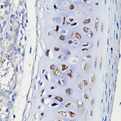 COMP / THBS5 Antibody - Immunohistochemistry of paraffin-embedded rat trachea using COMP antibody at dilution of 1:100 (40x lens).