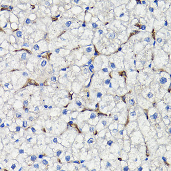 COMP / THBS5 Antibody - Immunohistochemistry of paraffin-embedded human liver using COMP antibody at dilution of 1:100 (40x lens).