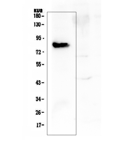 COMP / THBS5 Antibody - Western blot analysis of COMP using anti-COMP antibody. Electrophoresis was performed on a 5-20% SDS-PAGE gel at 70V (Stacking gel) / 90V (Resolving gel) for 2-3 hours. The sample well of each lane was loaded with 50ug of sample under reducing conditions. Lane 1: human placenta tissue lysates. After Electrophoresis, proteins were transferred to a Nitrocellulose membrane at 150mA for 50-90 minutes. Blocked the membrane with 5% Non-fat Milk/ TBS for 1.5 hour at RT. The membrane was incubated with rabbit anti-COMP antigen affinity purified polyclonal antibody at 0.5 µg/mL overnight at 4°C, then washed with TBS-0.1% Tween 3 times with 5 minutes each and probed with a goat anti-rabbit IgG-HRP secondary antibody at a dilution of 1:10000 for 1.5 hour at RT. The signal is developed using an Enhanced Chemiluminescent detection (ECL) kit with Tanon 5200 system. A specific band was detected for COMP at approximately 83KD. The expected band size for COMP is at 83KD.