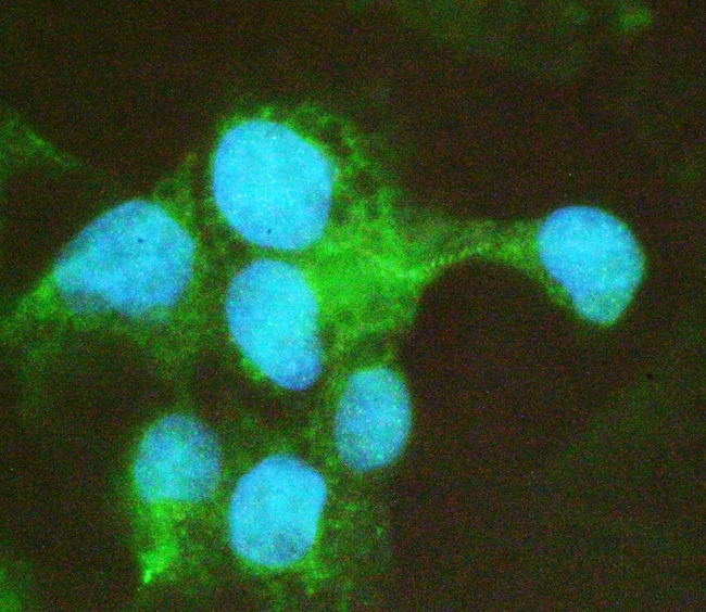 COMP / THBS5 Antibody - IF analysis of COMP using anti-COMP antibody COMP was detected in immunocytochemical section of HepG2 cell. Enzyme antigen retrieval was performed using IHC enzyme antigen retrieval reagent for 15 mins. The tissue section was blocked with 10% goat serum. The tissue section was then incubated with 2µg/mL rabbit anti-COMP Antibody overnight at 4°C. DyLight®488 Conjugated Goat Anti-Rabbit IgG was used as secondary antibody at 1:100 dilution and incubated for 30 minutes at 37°C. The section was counterstained with DAPI. Visualize using a fluorescence microscope and filter sets appropriate for the label used.