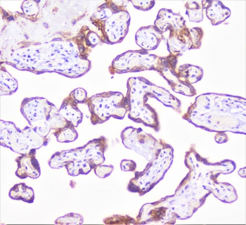 COMP / THBS5 Antibody - IHC staining of FFPE human placenta with COMP antibody at 1ug/ml. HIER: boil tissue sections in pH6, 10mM citrate buffer, for 10-20 min followed by cooling at RT for 20 min.