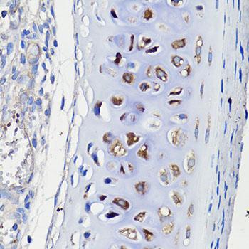 COMP / THBS5 Antibody - Immunohistochemistry of paraffin-embedded Rat trachea using COMP Polyclonal Antibody at dilution of 1:100 (40x lens).