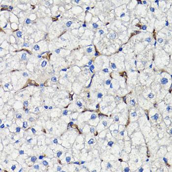 COMP / THBS5 Antibody - Immunohistochemistry of paraffin-embedded Human liver using COMP Polyclonal Antibody at dilution of 1:100 (40x lens).
