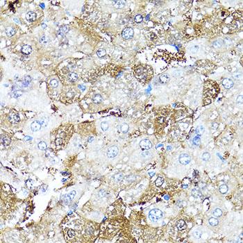 COMP / THBS5 Antibody - Immunohistochemistry of paraffin-embedded Mouse liver using COMP Polyclonal Antibody at dilution of 1:100 (40x lens).