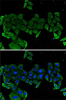 COMP / THBS5 Antibody - Immunofluorescence analysis of U2OS cells using COMP Polyclonal Antibody.