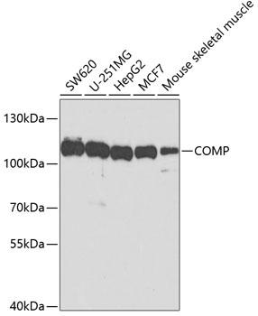 COMP / THBS5 Antibody - Western blot analysis of extracts of various cell lines using COMP Polyclonal Antibody at dilution of 1:1000.