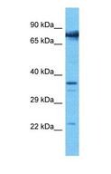 COMP / THBS5 Antibody - Western blot of COMP Antibody with human 786-0 Whole Cell lysate.  This image was taken for the unconjugated form of this product. Other forms have not been tested.