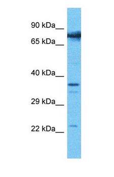 COMP / THBS5 Antibody - Western blot of COMP Antibody with human 786-0 Whole Cell lysate.  This image was taken for the unconjugated form of this product. Other forms have not been tested.