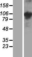 COMP / THBS5 Protein - Western validation with an anti-DDK antibody * L: Control HEK293 lysate R: Over-expression lysate