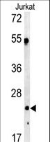 Complement C1QA Antibody - Western blot of C1QA antibody in Jurkat cell line lysates (35 ug/lane). C1QA (arrow) was detected using the purified antibody.