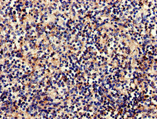Complement C1QA Antibody - Immunohistochemistry of paraffin-embedded human spleen tissue at dilution of 1:100