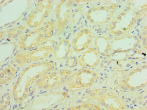 Complement C1QB Antibody - Immunohistochemistry of paraffin-embedded human kidney using antibody at 1:100 dilution.