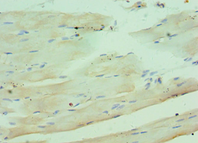 Complement C1QB Antibody - Immunohistochemistry of paraffin-embedded human skeletal muscle using antibody at 1:100 dilution.