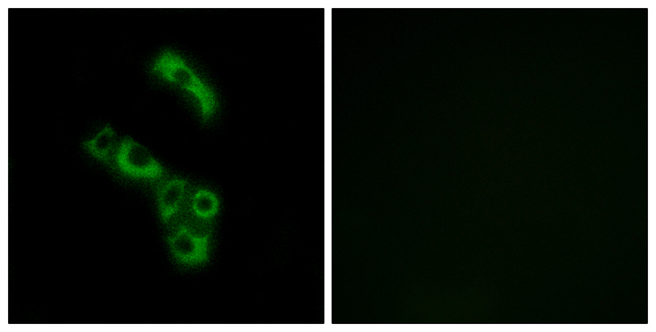 Complement C1QB Antibody - Immunofluorescence analysis of A549 cells, using C1QB Antibody. The picture on the right is blocked with the synthesized peptide.