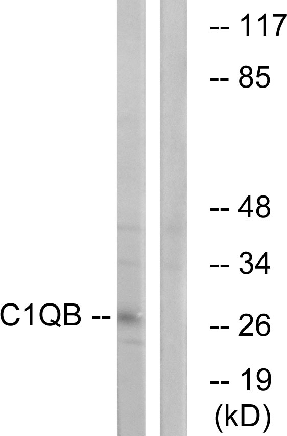 Complement C1QB Antibody - Western blot analysis of lysates from Jurkat cells, using C1QB Antibody. The lane on the right is blocked with the synthesized peptide.