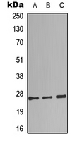Complement C1QB Antibody - Western blot analysis of Complement C1QB expression in Jurkat (A); rat lung (B); rat heart (C) whole cell lysates.