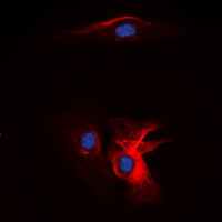 Complement C1QB Antibody - Immunofluorescent analysis of Complement C1QB staining in Jurkat cells. Formalin-fixed cells were permeabilized with 0.1% Triton X-100 in TBS for 5-10 minutes and blocked with 3% BSA-PBS for 30 minutes at room temperature. Cells were probed with the primary antibody in 3% BSA-PBS and incubated overnight at 4 ??C in a humidified chamber. Cells were washed with PBST and incubated with a DyLight 594-conjugated secondary antibody (red) in PBS at room temperature in the dark. DAPI was used to stain the cell nuclei (blue).
