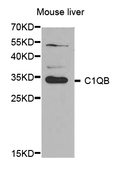 Complement C1QB Antibody - Western blot analysis of extracts of mouse liver.