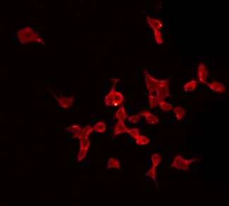 Complement C1QB Antibody - Staining HeLa cells by IF/ICC. The samples were fixed with PFA and permeabilized in 0.1% Triton X-100, then blocked in 10% serum for 45 min at 25°C. The primary antibody was diluted at 1:200 and incubated with the sample for 1 hour at 37°C. An Alexa Fluor 594 conjugated goat anti-rabbit IgG (H+L) Ab, diluted at 1/600, was used as the secondary antibody.