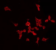 Complement C1QB Antibody - Staining HeLa cells by IF/ICC. The samples were fixed with PFA and permeabilized in 0.1% Triton X-100, then blocked in 10% serum for 45 min at 25°C. The primary antibody was diluted at 1:200 and incubated with the sample for 1 hour at 37°C. An Alexa Fluor 594 conjugated goat anti-rabbit IgG (H+L) Ab, diluted at 1/600, was used as the secondary antibody.