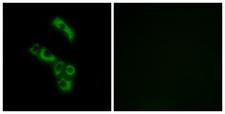 Complement C1QB Antibody - Peptide - + Immunofluorescence analysis of A549 cells, using C1QB antibody.