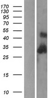 Complement C1QB Protein - Western validation with an anti-DDK antibody * L: Control HEK293 lysate R: Over-expression lysate