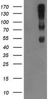 Complement C1R Antibody - HEK293T cells were transfected with the pCMV6-ENTRY control (Left lane) or pCMV6-ENTRY C1R (Right lane) cDNA for 48 hrs and lysed. Equivalent amounts of cell lysates (5 ug per lane) were separated by SDS-PAGE and immunoblotted with anti-C1R.