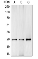 Complement C1R Antibody - Western blot analysis of Complement C1R LC expression in HEK293T (A); mouse liver (B); rat kidney (C) whole cell lysates.